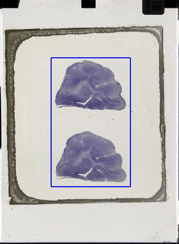 Media type: image; Special Collections 3043   shows specimen_part histological serial section;
